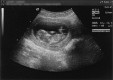  First scan