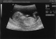  First scan