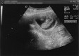  First scan